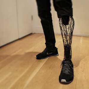 Exo-Prosthetics: Light, Cheap & Custom 3D-Printed Body Parts | Urbanist