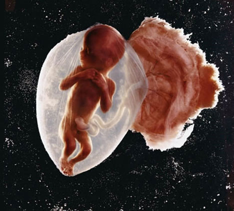 floating-fetus-life-magazine