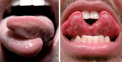 Split-Tongue