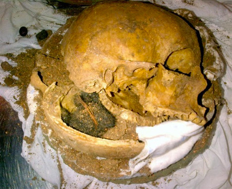 TSA Confiscated Human Skull
