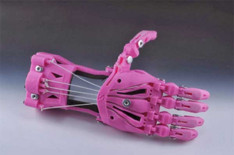3D Printing Disabilities Hand Children 1