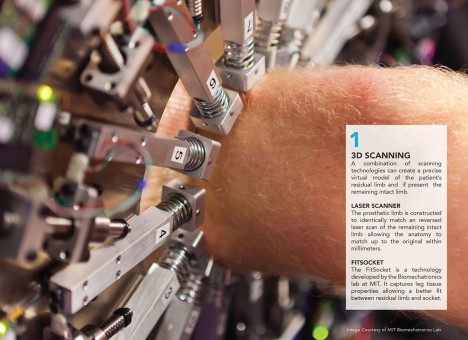 3d scanned bio limb